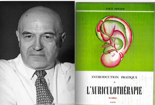 西洋医学における耳つぼの歴史
